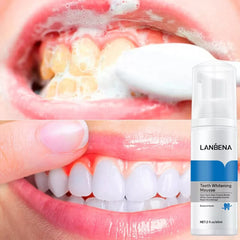 Teeth Whitening Foam